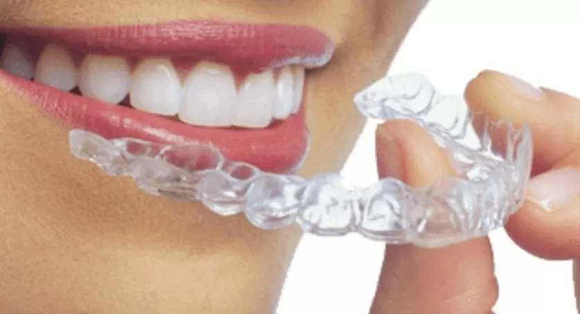 Invisalign